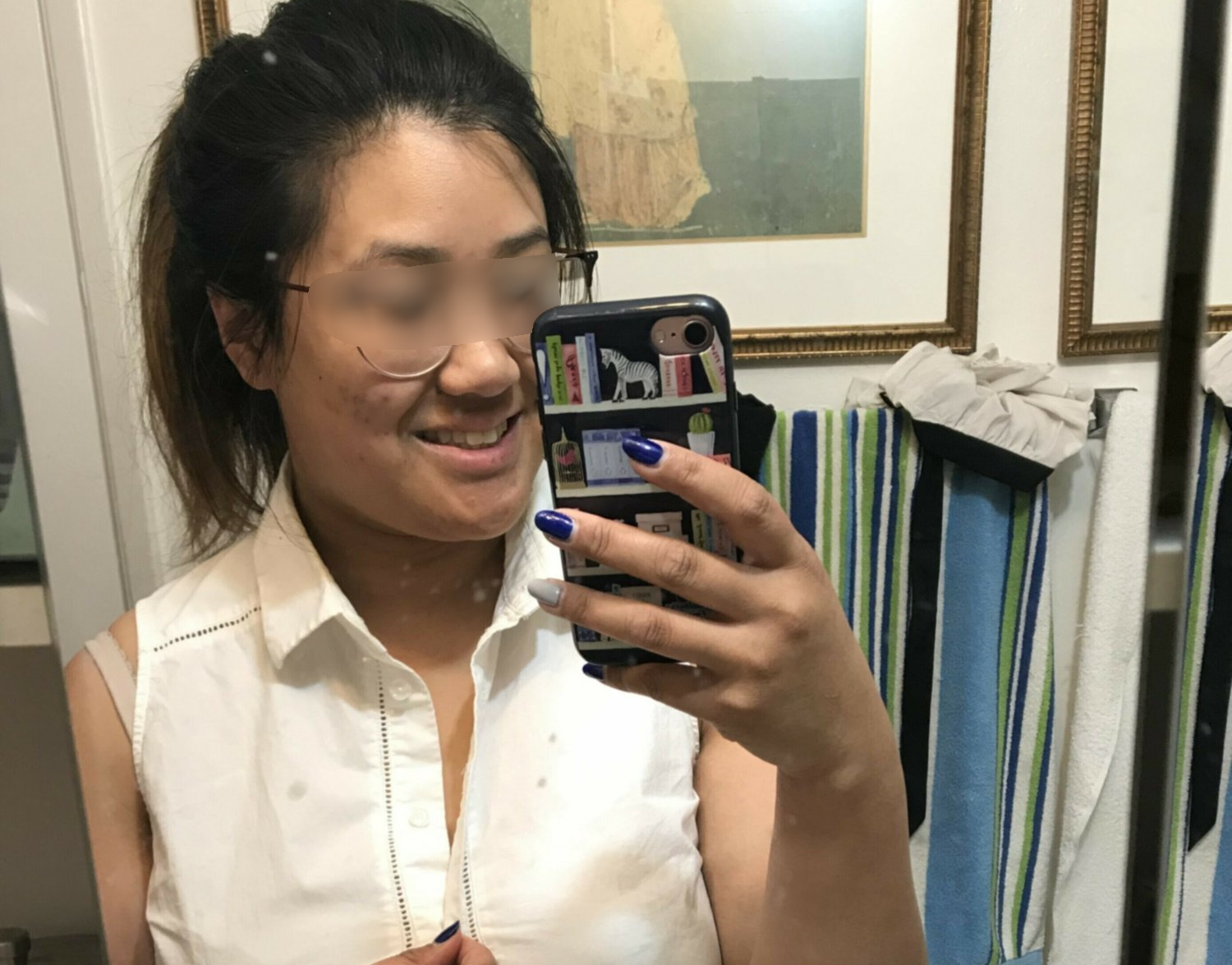 Fat ugly asian with hige boobs